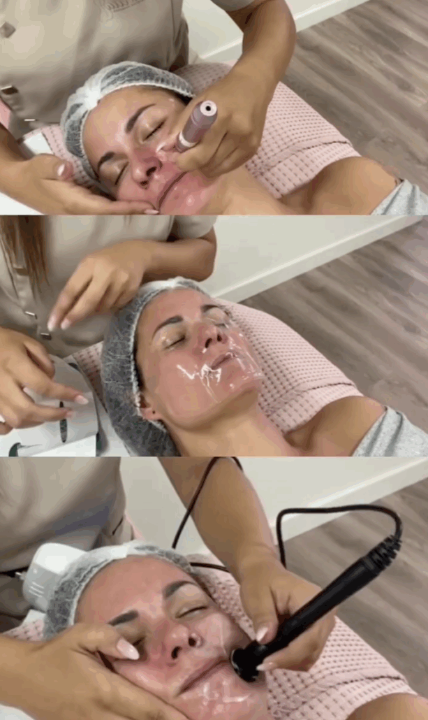 revitalise detox estética avanzada