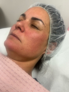 gel perla green sea peel